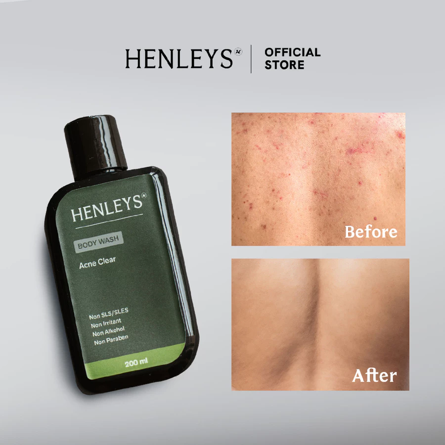 id-11134207-822wh-mlc8bw5li1ad80@resize_w900_nl